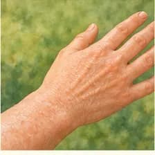 skin — پوست