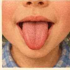 tongue — լեզու
